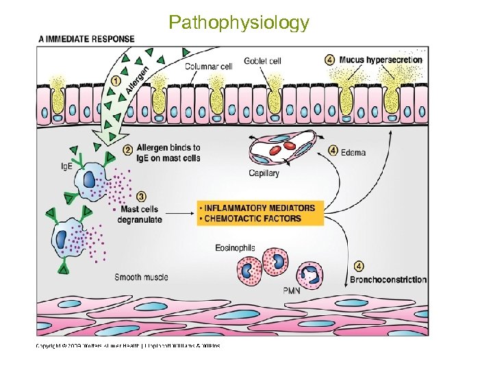 Pathophysiology 