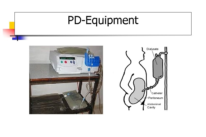 PD-Equipment 