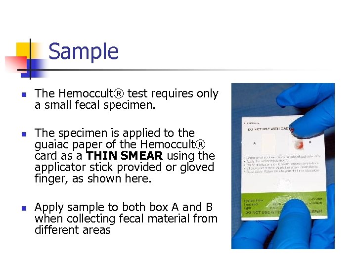 Sample n n n The Hemoccult® test requires only a small fecal specimen. The