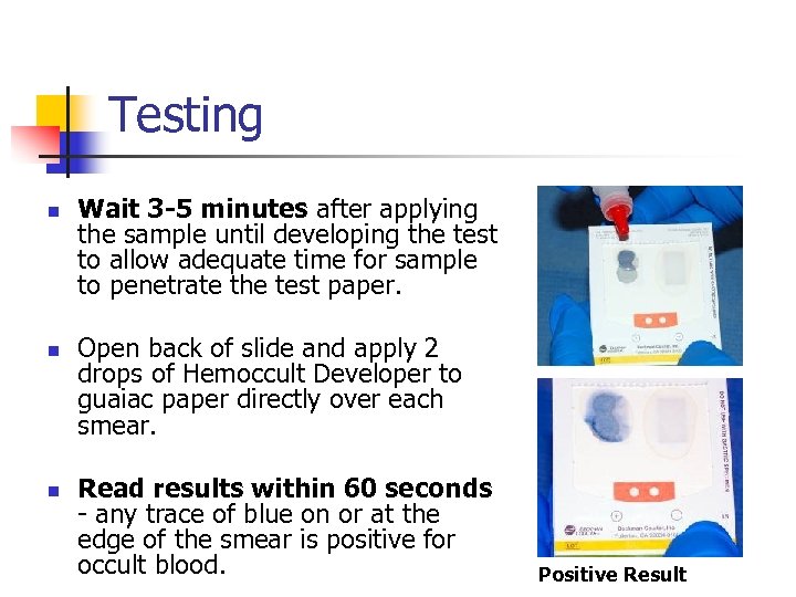 Testing n n n Wait 3 -5 minutes after applying the sample until developing