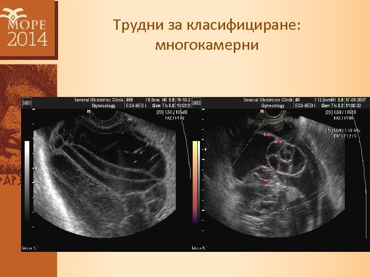 Трудни за класифициране: многокамерни 