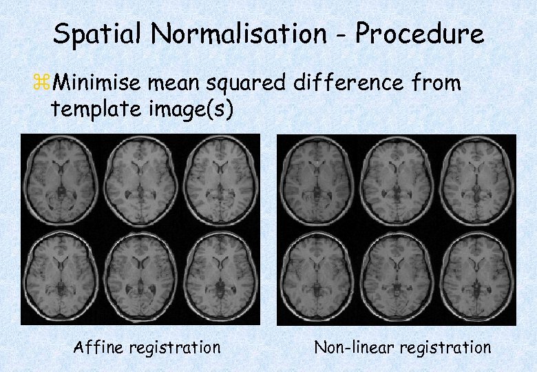 Spatial Normalisation - Procedure z. Minimise mean squared difference from template image(s) Affine registration