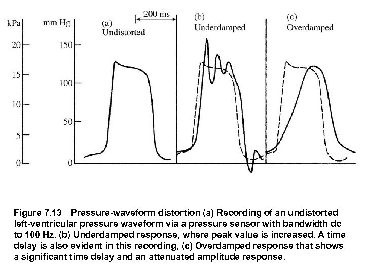 Figure 7. 13 Pressure waveform distortion (a) Recording of an undistorted left ventricular pressure waveform
