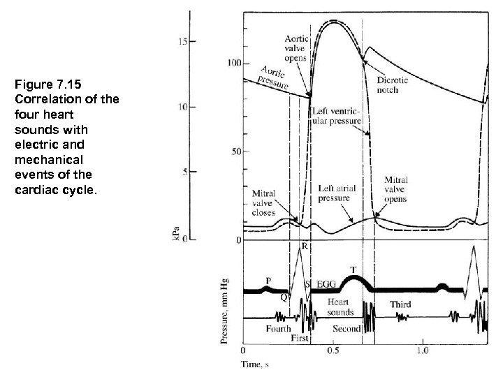 Figure 7. 15  Correlation of the four heart sounds with electric and mechanical events