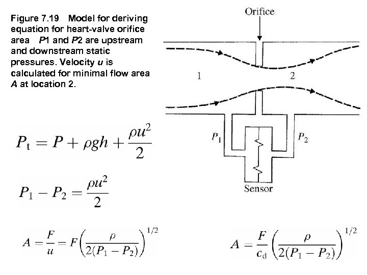 Figure 7. 19 Model for deriving equation for heart valve orifice area P 1 and P