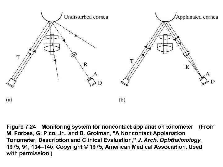 Figure 7. 24 Monitoring system for noncontact applanation tonometer (From M. Forbes, G. Pico, Jr. ,