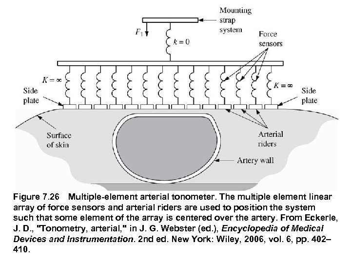Figure 7. 26 Multiple element arterial tonometer. The multiple element linear array of force sensors