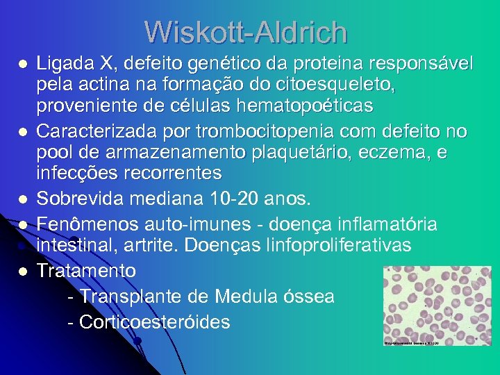 Wiskott-Aldrich l l l Ligada X, defeito genético da proteina responsável pela actina na