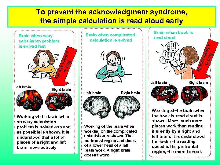 To prevent the acknowledgment syndrome, the simple calculation is read aloud early Brain when
