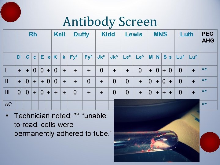 Antibody Screen Rh D Kell C c E e K Duffy k Fya Kidd