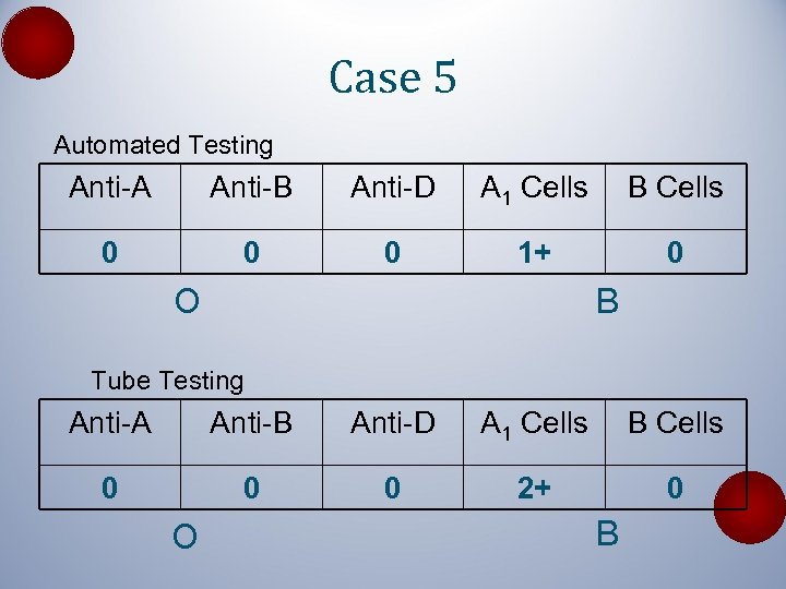 Case 5 Automated Testing Anti-A Anti-B Anti-D A 1 Cells B Cells 0 0