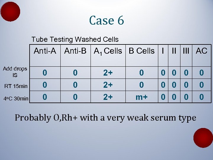 Case 6 Tube Testing Washed Cells Anti-A Anti-B A 1 Cells B Cells I