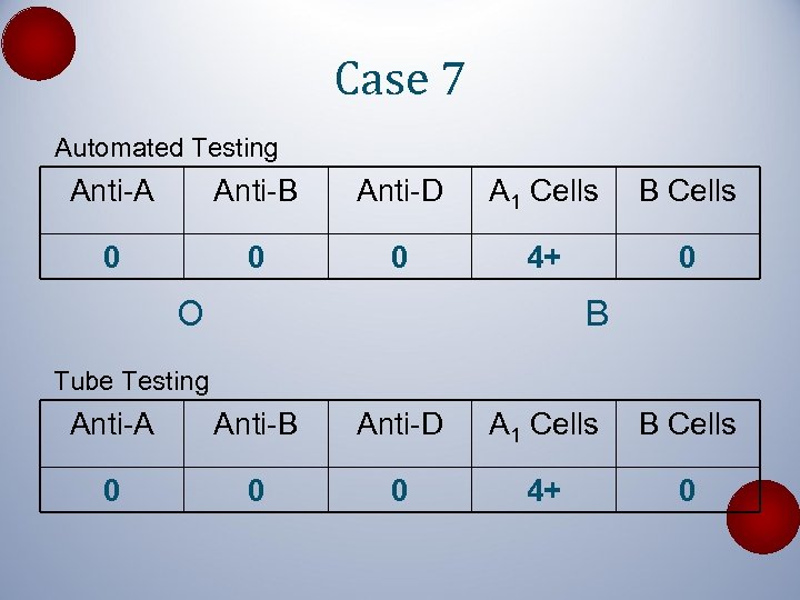 Case 7 Automated Testing Anti-A Anti-B Anti-D A 1 Cells B Cells 0 0