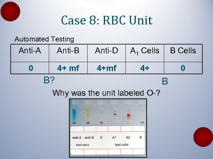 Case 8: RBC Unit Automated Testing Anti-A Anti-B Anti-D A 1 Cells B Cells