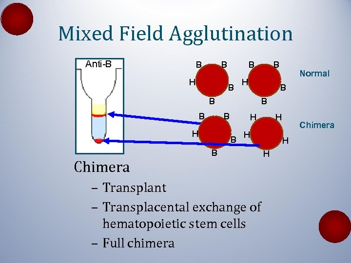 Mixed Field Agglutination Anti-B B B H Chimera B B H Normal B B