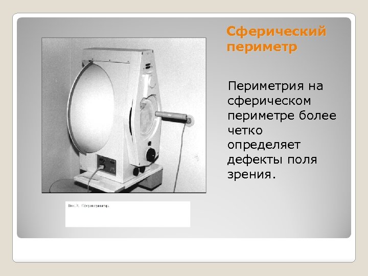 Сферический периметр Периметрия на сферическом периметре более четко определяет дефекты поля зрения. 