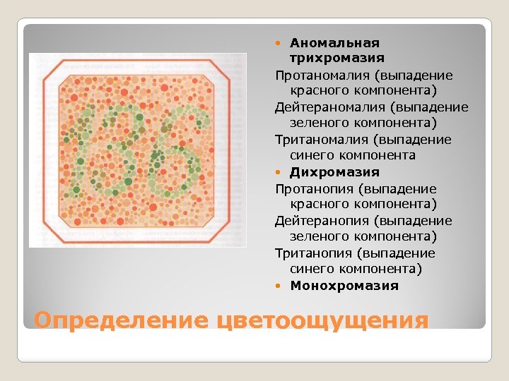 Аномальная трихромазия Протаномалия (выпадение красного компонента) Дейтераномалия (выпадение зеленого компонента) Тританомалия (выпадение синего компонента