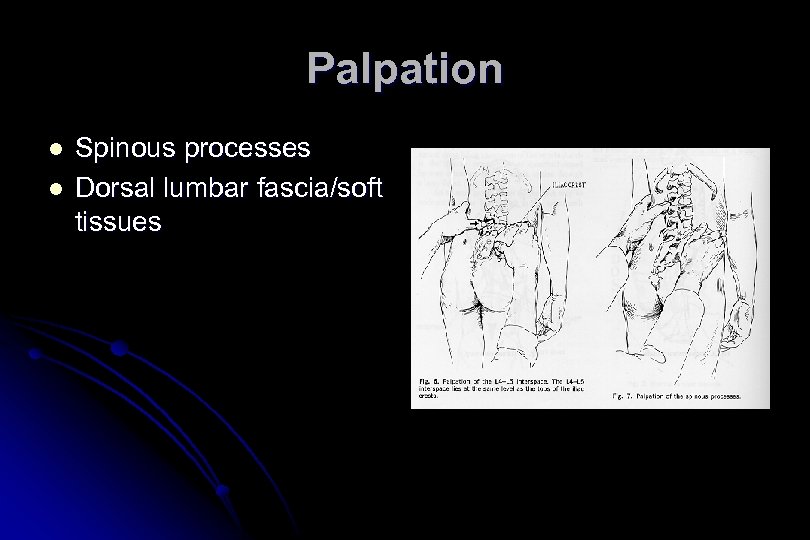 Palpation l l Spinous processes Dorsal lumbar fascia/soft tissues 