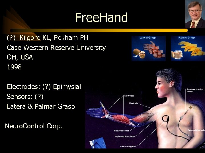 Free. Hand (? ) Kilgore KL, Pekham PH Case Western Reserve University OH, USA