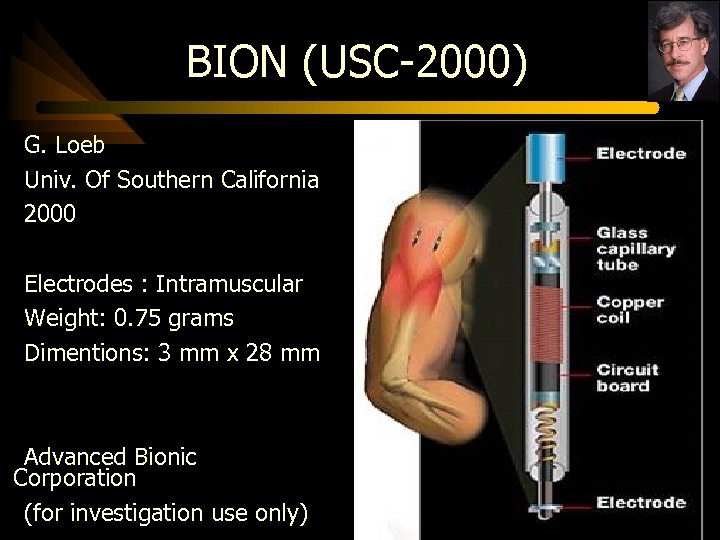 BION (USC-2000) G. Loeb Univ. Of Southern California 2000 Electrodes : Intramuscular Weight: 0.