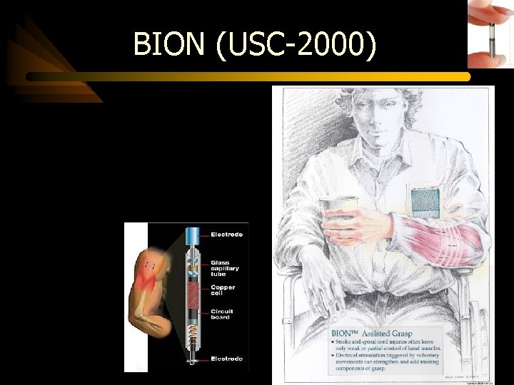 BION (USC-2000) 