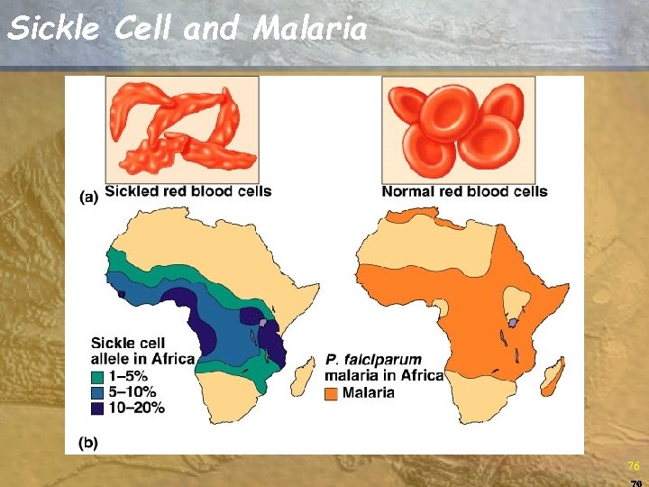 Sickle Cell and Malaria 76 76 