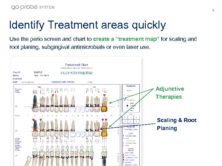 SYSTEM 9 Identify Treatment areas quickly Use the perio screen and chart to create