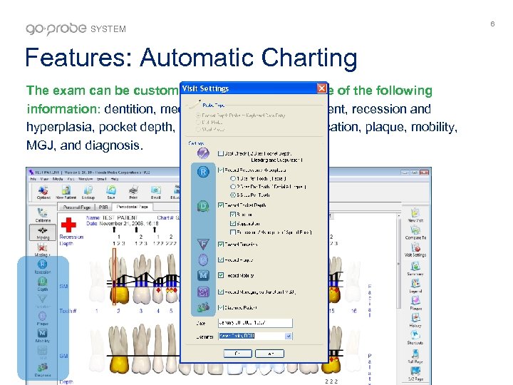 SYSTEM Features: Automatic Charting The exam can be customized to record all or some