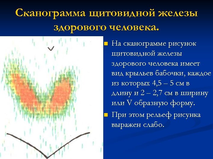 Сканограмма щитовидной железы здорового человека. n n На сканограмме рисунок щитовидной железы здорового человека