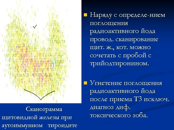 n n Сканограмма щитовидной железы при аутоиммунном тироидите Наряду с определе-нием поглощения радиоактивного йода