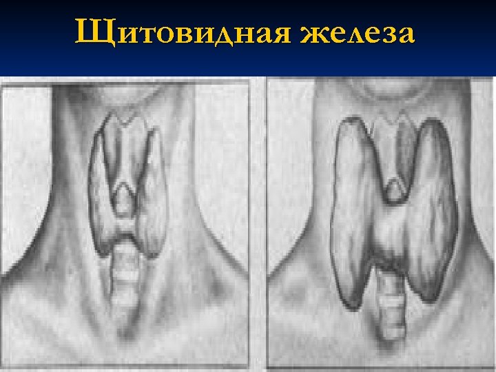 Щитовидная железа 