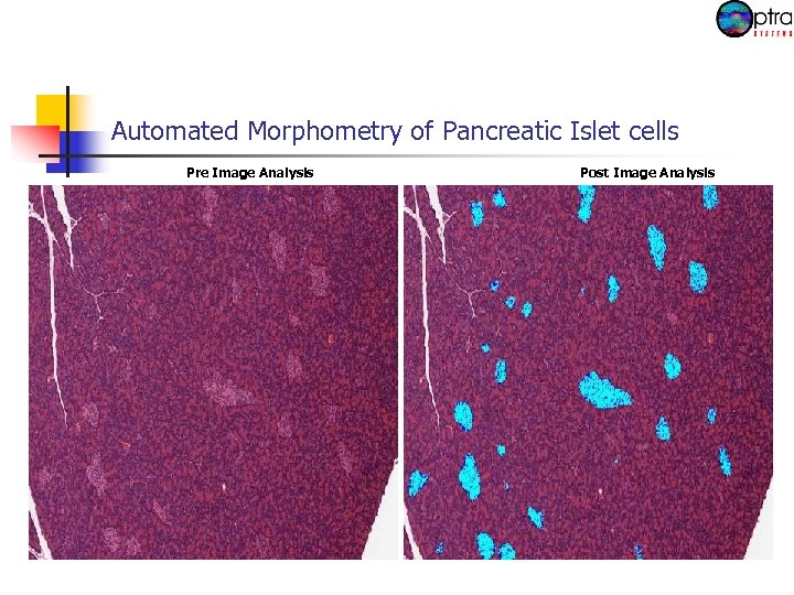 Automated Morphometry of Pancreatic Islet cells Pre Image Analysis Post Image Analysis 