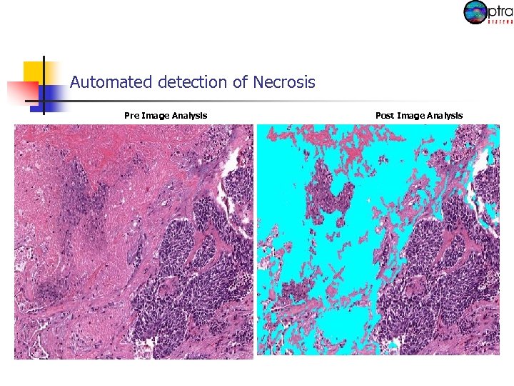 Automated detection of Necrosis Pre Image Analysis Post Image Analysis 