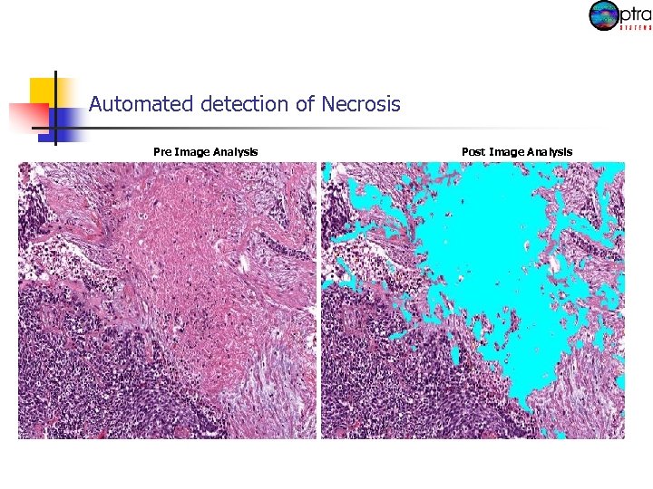 Automated detection of Necrosis Pre Image Analysis Post Image Analysis 