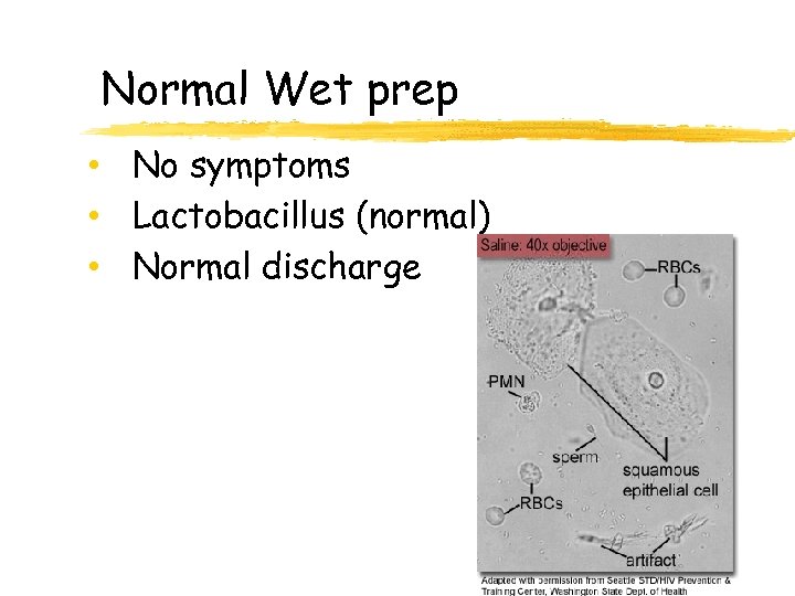 Normal Wet prep • No symptoms • Lactobacillus (normal) • Normal discharge 108 
