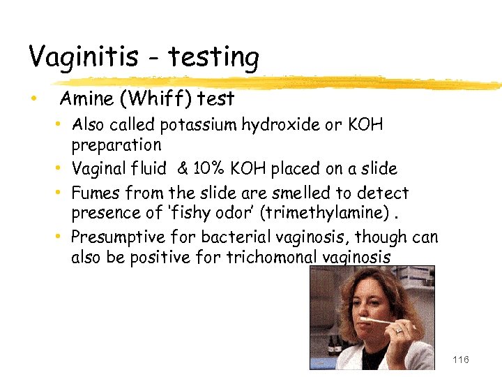 Vaginitis - testing • Amine (Whiff) test • Also called potassium hydroxide or KOH
