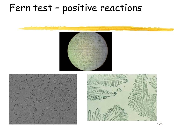 Fern test – positive reactions 125 