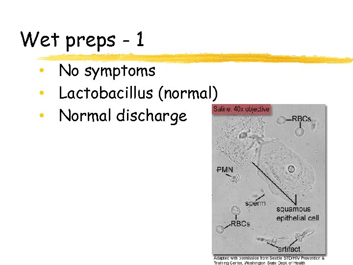Wet preps - 1 • No symptoms • Lactobacillus (normal) • Normal discharge 127