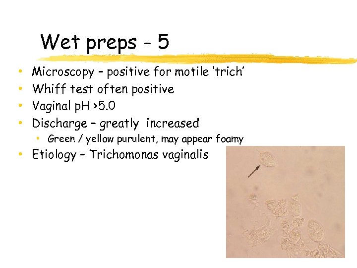 Wet preps - 5 • • Microscopy – positive for motile ‘trich’ Whiff test