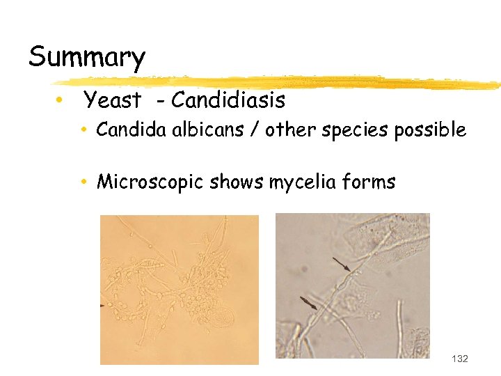 Summary • Yeast - Candidiasis • Candida albicans / other species possible • Microscopic