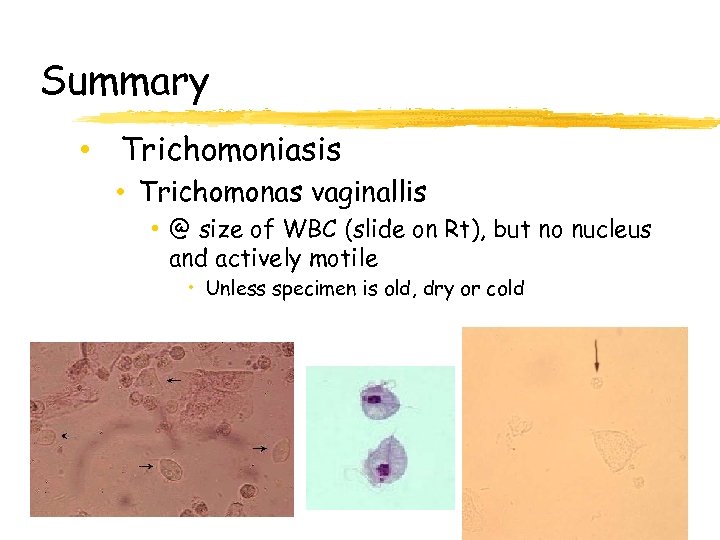 Summary • Trichomoniasis • Trichomonas vaginallis • @ size of WBC (slide on Rt),