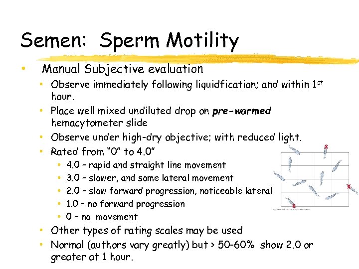 Semen: Sperm Motility • Manual Subjective evaluation • Observe immediately following liquidfication; and within