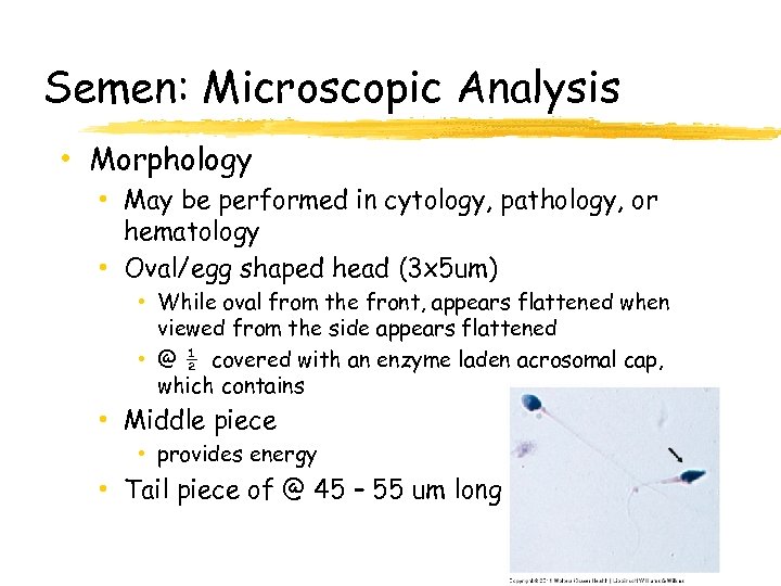 Semen: Microscopic Analysis • Morphology • May be performed in cytology, pathology, or hematology