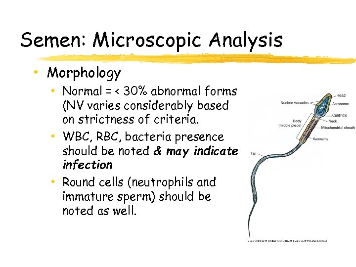 Semen: Microscopic Analysis • Morphology • Normal = < 30% abnormal forms (NV varies