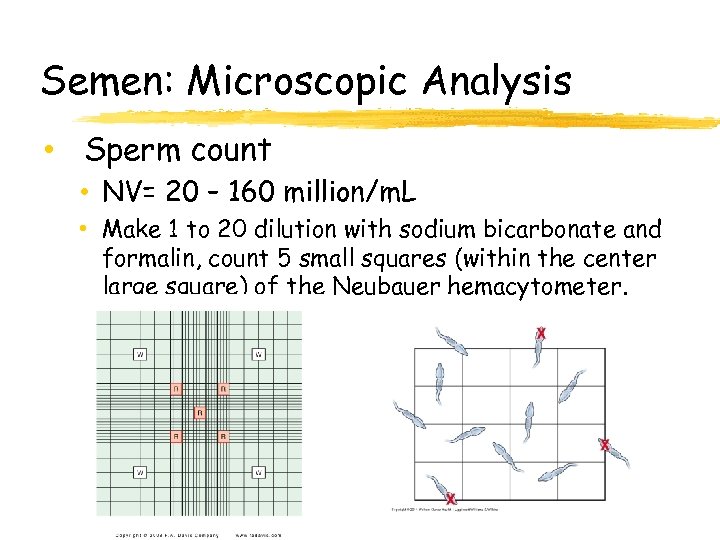 Semen: Microscopic Analysis • Sperm count • NV= 20 – 160 million/m. L •
