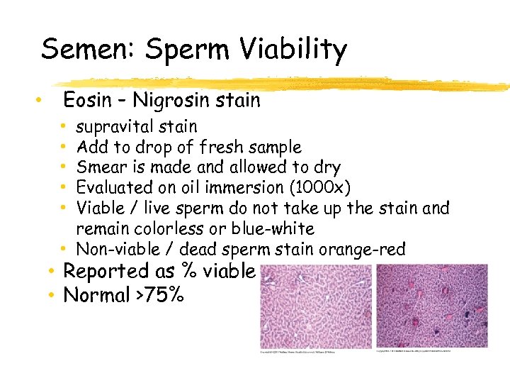 Semen: Sperm Viability • Eosin – Nigrosin stain supravital stain Add to drop of