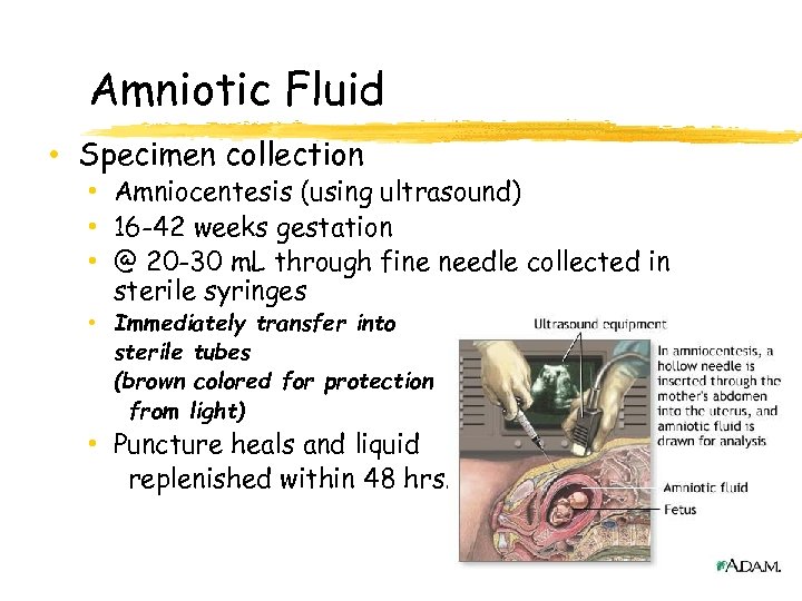 Amniotic Fluid • Specimen collection • Amniocentesis (using ultrasound) • 16 -42 weeks gestation