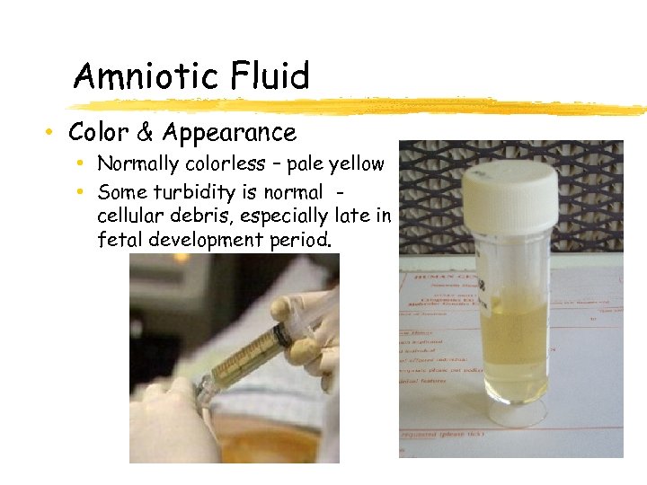 Amniotic Fluid • Color & Appearance • Normally colorless – pale yellow • Some