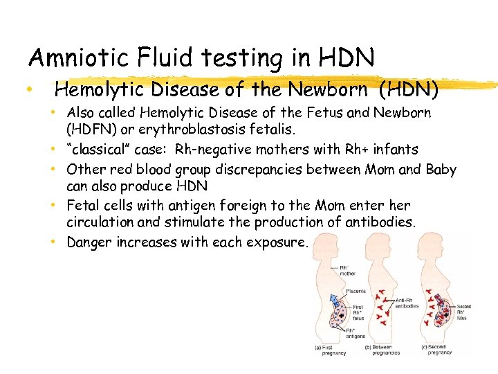 Amniotic Fluid testing in HDN • Hemolytic Disease of the Newborn (HDN) • Also