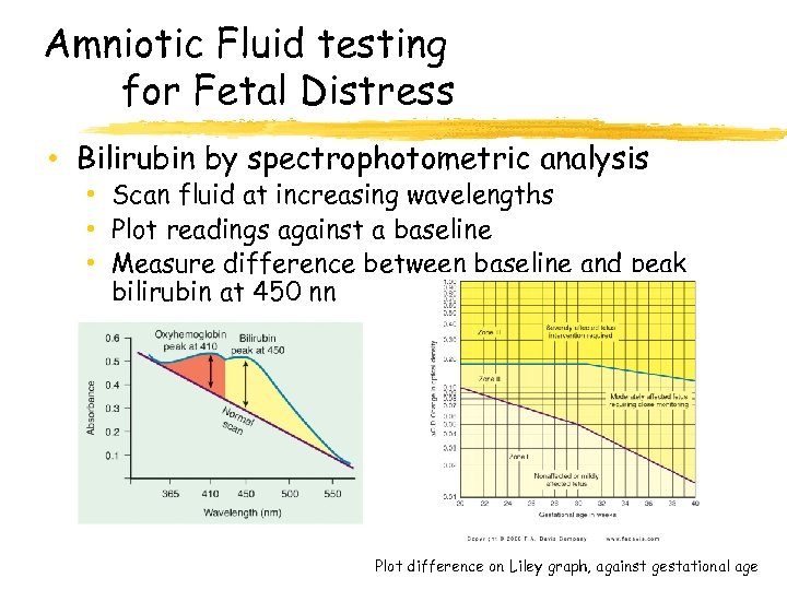Amniotic Fluid testing for Fetal Distress • Bilirubin by spectrophotometric analysis • Scan fluid